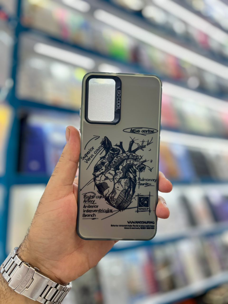 قاب سوکول طرح قلبی شیائومی Note 10 4g